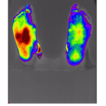Thermogram | Plantar skin | PEMF | Improvement | Stimulus