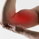 Pulsed ElectroMagnetic Fields | PEMFS | Muscle Soreness | Exercise | Bicep Pain