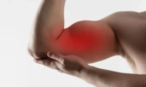 Man holds up arm and it is clear that bicep is sore since it's shaded red