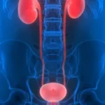 Urinary Stress | Incontinence | High Intensity | PEMF Therapy